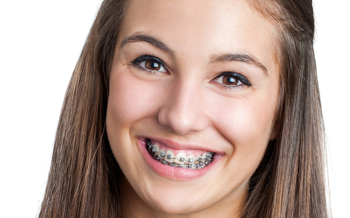 Orthodontics options for straight teeth and a beautiful smile