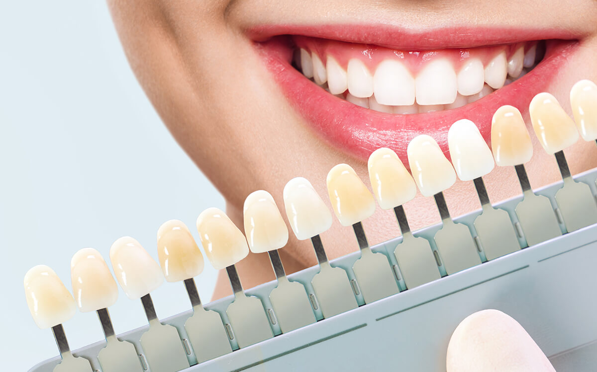 Transform your smile with beautiful, durable Porcelain Dental Veneers
