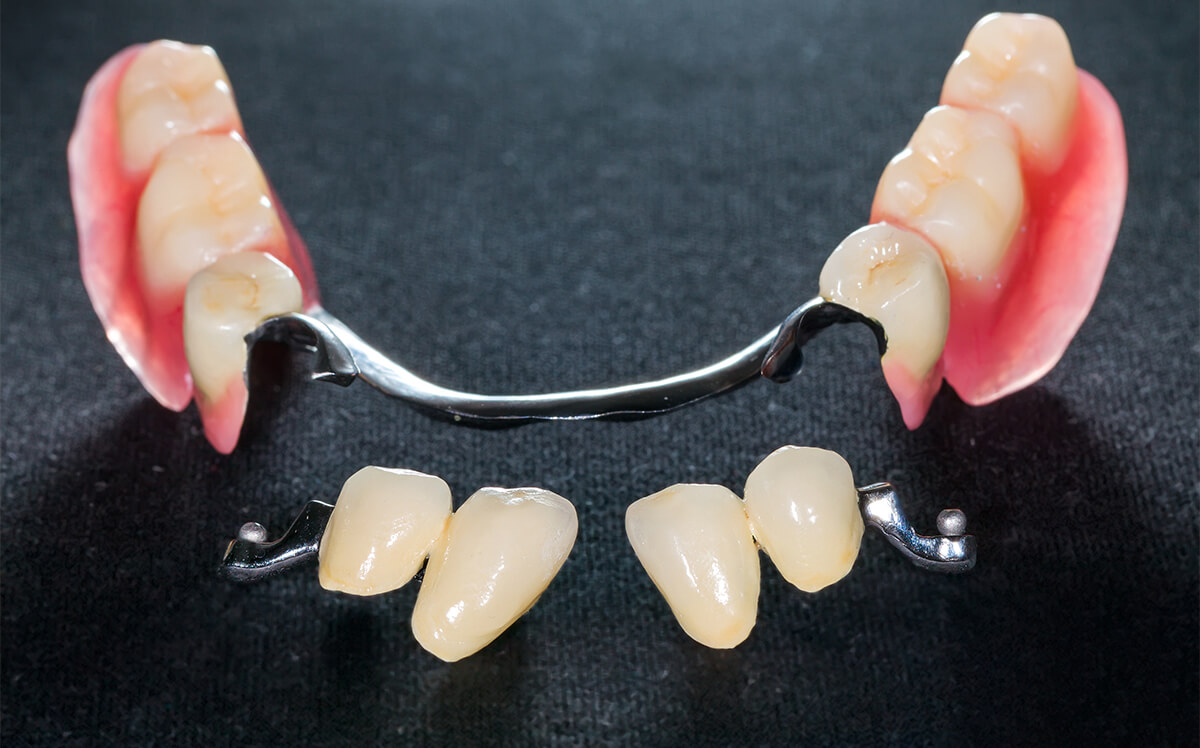 Cosmetic Dentures Teeth in Payson UT Area