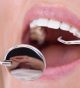 Keep Your Teeth Healthy and Strong with Routine Dental Cleanings