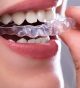 Our Cosmetic Orthodontist Can Straighten Your Smile with Style